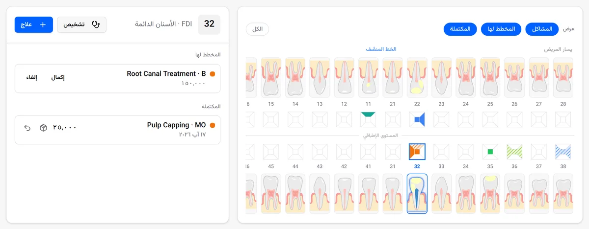 المخطط السني لمريض في كاكيلة، مع العلاجات المخططة والمكتملة على سن واحد