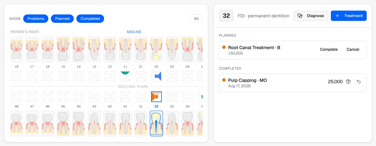 A patient's dental chart in Kakile, with the planned and completed treatments on one tooth